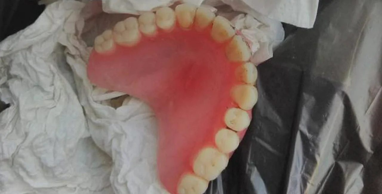 Czech village seeks owner of dentures vomited in street