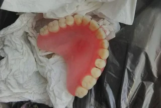 Czech village seeks owner of dentures vomited in street